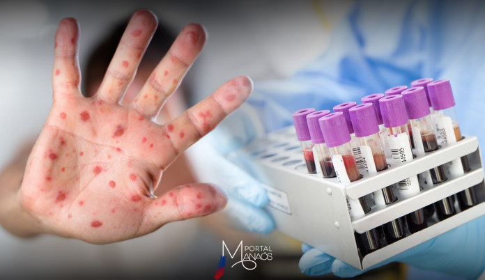 capa-monkeypox-japão