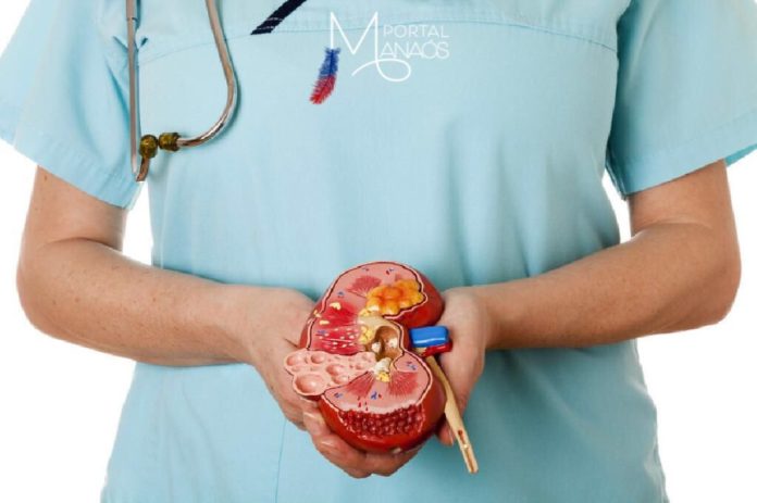 capa pedra nos rins Pedra no rim: SES orienta como prevenir e tratar a doença