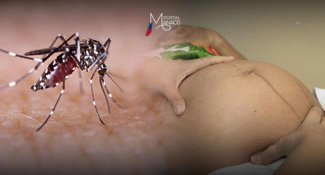 Saúde alerta para novos casos de zika em gestantes no Amazonas