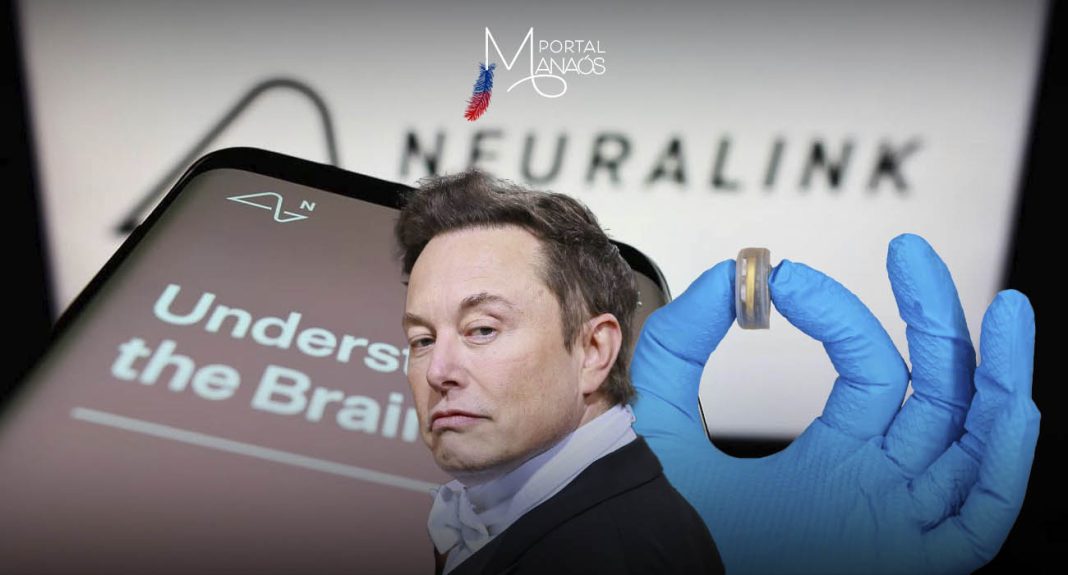 Empresa de Elon Musk poderá testar chips cerebrais em humanos