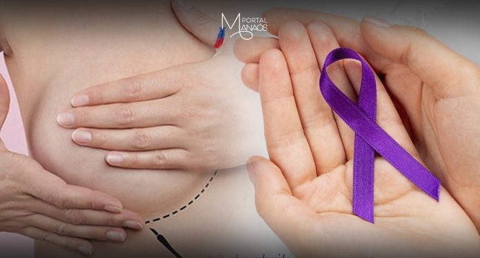 Câncer, Mama, Cuidado, Saúde, Prevenção,