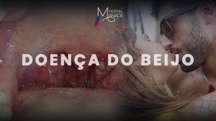 capa beijo manaos (1)