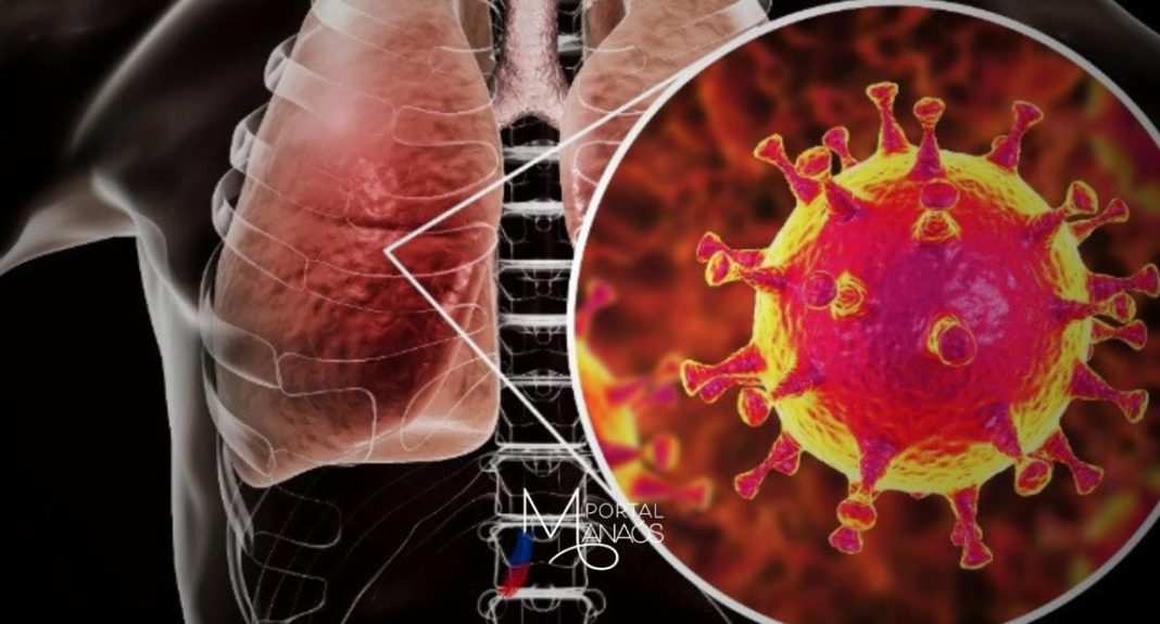 Divulgado na última quinta-feira (28), o novo Boletim InfoGripe da Fiocruz aponta aumento dos casos de Síndrome Respiratória Aguda Grave (SRAG) em crianças, jovens e adultos no cenário nacional. O atual quadro é decorrente do crescimento, em diversos estados, de diferentes vírus respiratórios como influenza (gripe), vírus sincicial respiratório (VSR) e rinovírus.