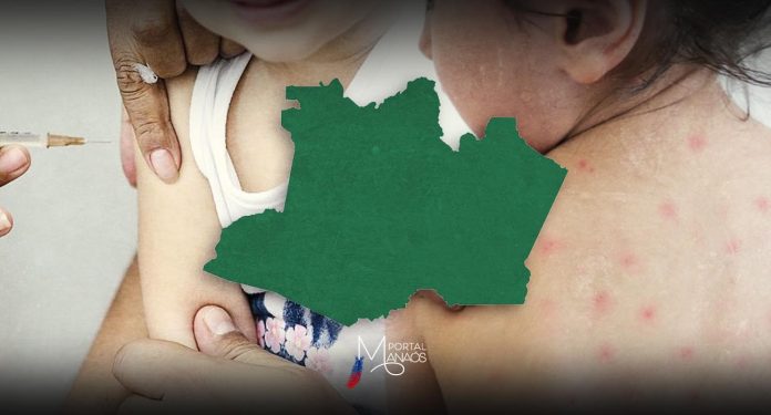 Amazonas, Ministério da Saúde, Vacinação, Sarampo,