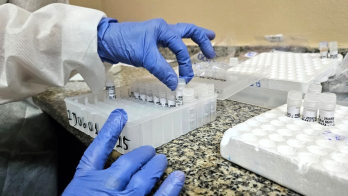 FVS-RCP_Informe-Virus-Respiratorios_FOTO-Girlene-Medeiros-FVS-RCP