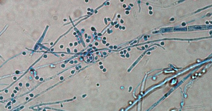 20250320_trichophyton-indotinea